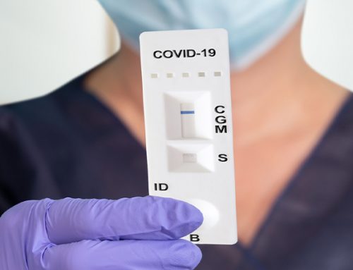 Antibody Testing for Coronavirus